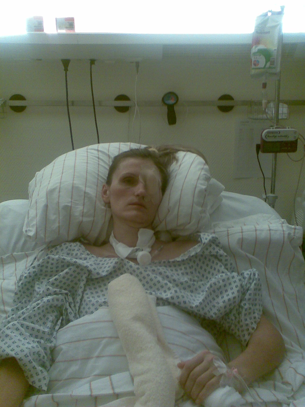 Cover: Video Wachkoma